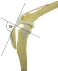 Cranial Cruciate Disease
