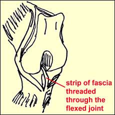 Cranial Cruciate Disease